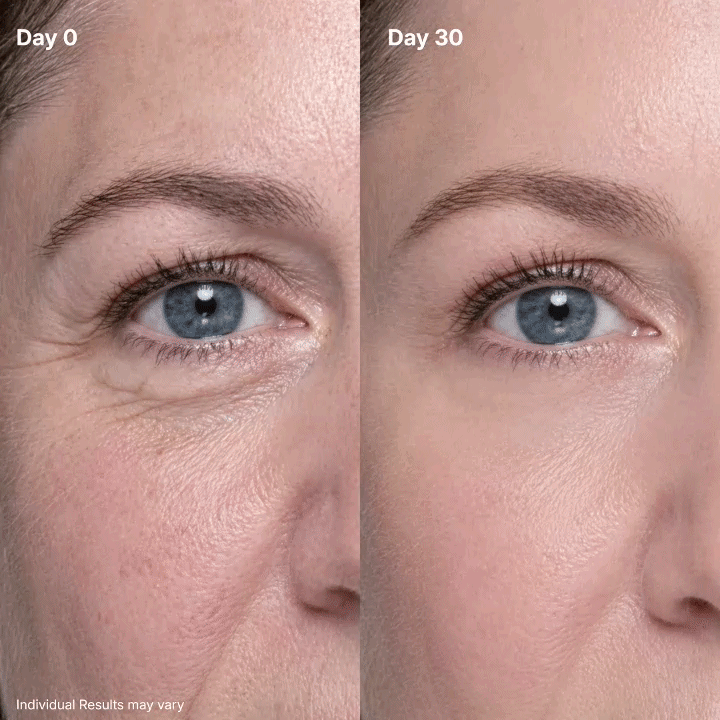🔥Final 2 Hour 50% OFF🔥 AQA Eye Renewal Cream