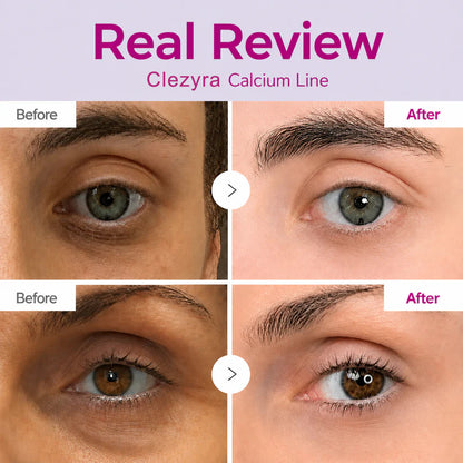 🔥LAST DAY 50% OFF!!Clezyra  Korean Calcium Dark Spot Eye Cream