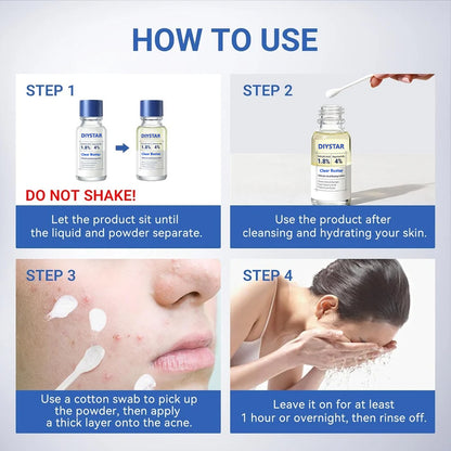 DIYSTAR Acne Drying Lotion Plus Acne Spot Treatment 20 mL